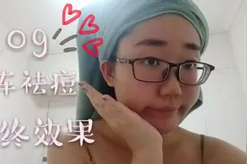 医美日记②|点阵激光祛痘印效果到底怎么样，恢复后效果大揭秘~视频封面