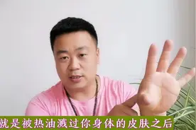 热油烫伤小妙招，还有比这更实用的吗？视频封面