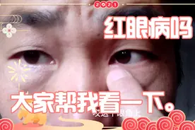 早上起来突然发现眼角有一颗红点是发炎了，请问有什么办法可以治视频封面