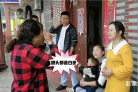 二嫂额头几个月一直脱皮，家人各说其词，今天去看医生是这么说视频封面