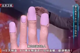 水肿，指甲变软，出现这些状况可能是蛋白质缺乏导致的！快补起来视频封面