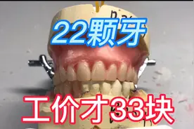 一套22颗的假牙，制作工价才33块钱。视频封面