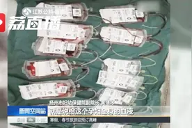 产妇分娩遇意外 全身血液都换一遍 医生挑战超高难度手术视频封面