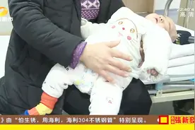 太大意！四个月女婴脚趾被线缠住，粗心妈妈5天未发现！视频封面