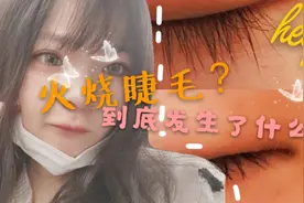 在线求助|用火安全|只是想热个鸡蛋却烧到睫毛，请大家引以为戒视频封面