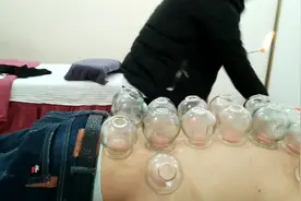 拔罐效果非常好，祛寒除湿，缓解腰背酸疼，大家看看吧！视频封面