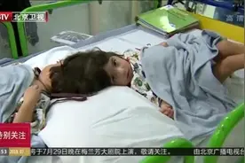 双胞胎女孩天生头部相连 英国医院成功实施分离手术视频封面