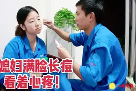 媳妇脸上长满痘，看着让人心疼，小朱网购凝胶试试效果视频封面