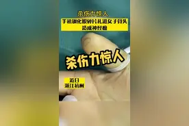 可怕！堪比刀片！#破碎手机膜扎进女子手指骨 一查居然长出了瘤…