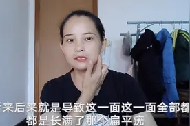 困扰我多年的扁平疣终于治好了 方法和药方全部在这 来了解一下吧