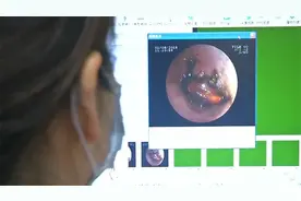 “可怕”！男子左耳疼痛难忍、嗡嗡作响，竟是蟑螂在里“搭窝”视频封面