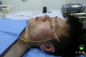青春痘本是青春期才有的，可为什么四十多岁的人也会长痘？来看看