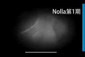 牙齿钙化的10个阶段视频封面