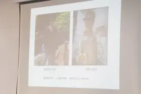 西南地区首例！小肠移植成功！患者目前恢复良好视频封面