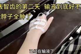 拔智齿的第二天，脸和脖子喉咙全肿了，输液到底好不好？视频封面