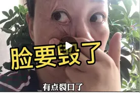 祛斑把脸去掉一层皮，小田还要继续坚持，你觉得有必要吗？视频封面