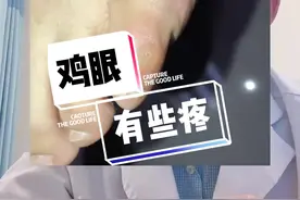 脚上长鸡眼，有些疼，怎么办？#鸡眼 #跖疣 #医学科普 @DOU+小助手视频封面