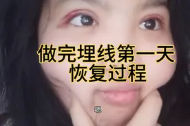 埋线恢复全过程 比第一天好多了 网传十天就能恢复是真的吗?视频封面