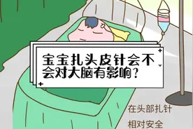 宝宝扎头皮针会不会对大脑有影响？视频封面