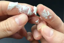 去胶水印还在用手抠？只需一招，手上、桌子、玻璃，轻松去除干净视频封面