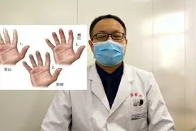 什么是雷诺综合征？应该如何治疗？💁视频封面