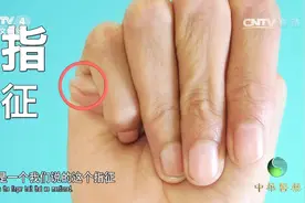 手指细长就一定是马凡氏综合征吗？专家提出鉴别方法，一起来看看视频封面