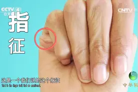 手指细长就一定是马凡氏综合征吗？专家提出鉴别方法，一起来看看视频封面