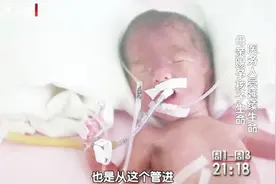 熊猫血妈妈8：母子同时面临死亡威胁，早产儿在保温箱中艰难生长视频封面