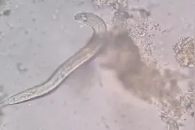 人体消化道寄生虫！视频封面