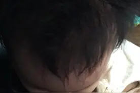 孕期吃了上万块钱的黑葡萄，这双眼睛能拯救一张脸吗？视频封面