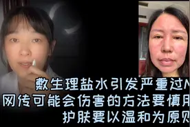 敷生理盐水引发严重过敏，但凡有伤害几率的就不要轻易尝试视频封面