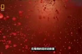 医学3D动画演示：冠状动脉斑块的形成及危害，其中斑块破裂最可怕视频封面