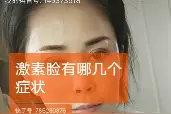 激素脸的特征视频封面