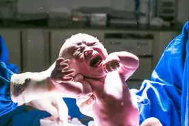 实拍孕妇剖腹产的前后过程，做妈妈真的好辛苦，一定要好好爱妈妈视频封面