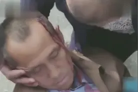 特种兵偶遇车祸现场，于是奋力抢救，兽医也能救人了啊！视频封面