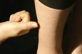 眼睛发痒、发疼怎么办？按摩这个穴位可缓解症状，并预防多种眼病视频封面