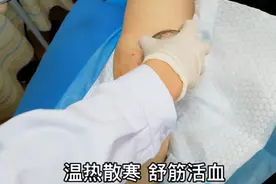 80岁奶奶受凉老寒腿疼痛发作，坚强接受刺血拔罐，治完立感轻松视频封面