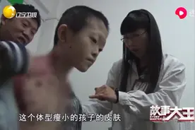 小男孩身上不断散发出异味，医生检查后都被震惊了！视频封面
