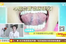 女子长期穿高跟鞋竟导致下肢静脉曲张？医生：警惕不同部位的青筋视频封面