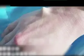 看着都疼！学网上用筷子开啤酒反被扎！这不是吓唬你，已发生多起视频封面