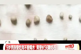 爱吃肉不爱喝水！9岁男孩身体里竟藏有56颗肾结石，医生都吓一跳视频封面