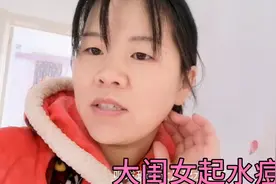 大闺女在学校传染起水痘了，吃狗肉管用吗视频封面
