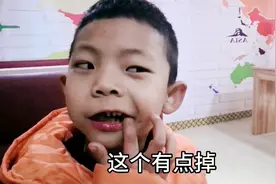 小伙子吃汉堡竟然把牙硌掉了，看这大黑牙，被腐蚀成这样视频封面