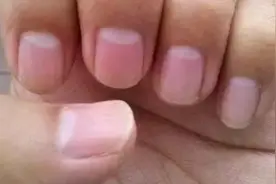 指甲上的半月牙代表什么？是不是月牙越大越健康视频封面