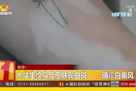 女大学生好奇纹身，事后发现皮肤出现白斑，被确诊为白癜风！视频封面