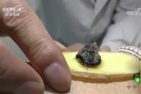 用瘢痕灸灸足三里穴真的可以百病消吗？来听听专家怎么说视频封面
