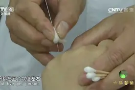这种针灸疗法出入针迅速，却宣称能3秒见效，这是真的吗？视频封面