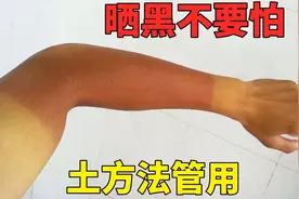 夏天晒黑不要怕，教你一个土方法，简单好用又省钱，适合军训同学视频封面