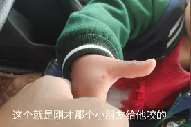 刚接到在读幼儿园侄女被同学咬了，建议去打破伤风视频封面