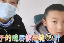 9岁儿子骑自行车不慎摔倒，嘴唇磕破缝了4针，希望不要留疤！视频封面